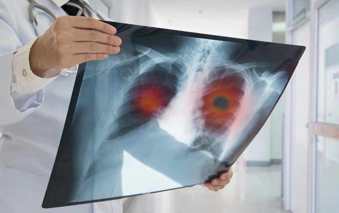 626631452 Doctor holding lung X-ray with highlighted areas.