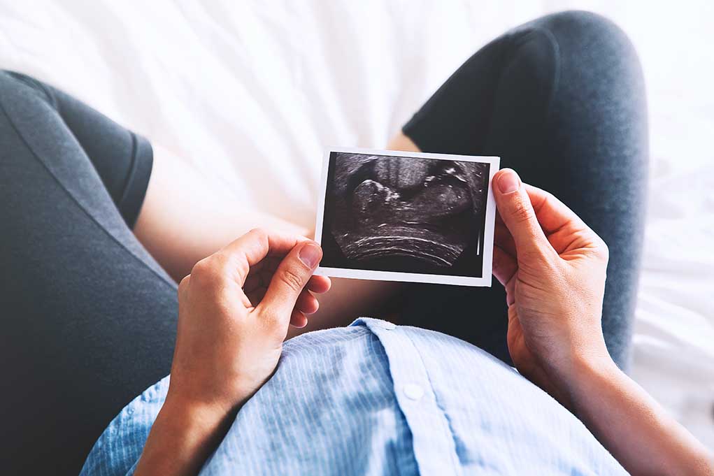Person holding ultrasound image over pregnant belly