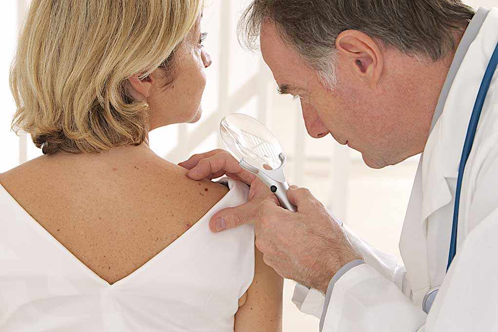 Doctor examining a patients skin with a magnifying glass