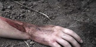 Injured arm partially buried in dirt.