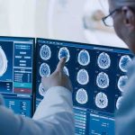 AI Rebuilds What Eyes See Doctors reviewing brain MRI scans on multiple monitors